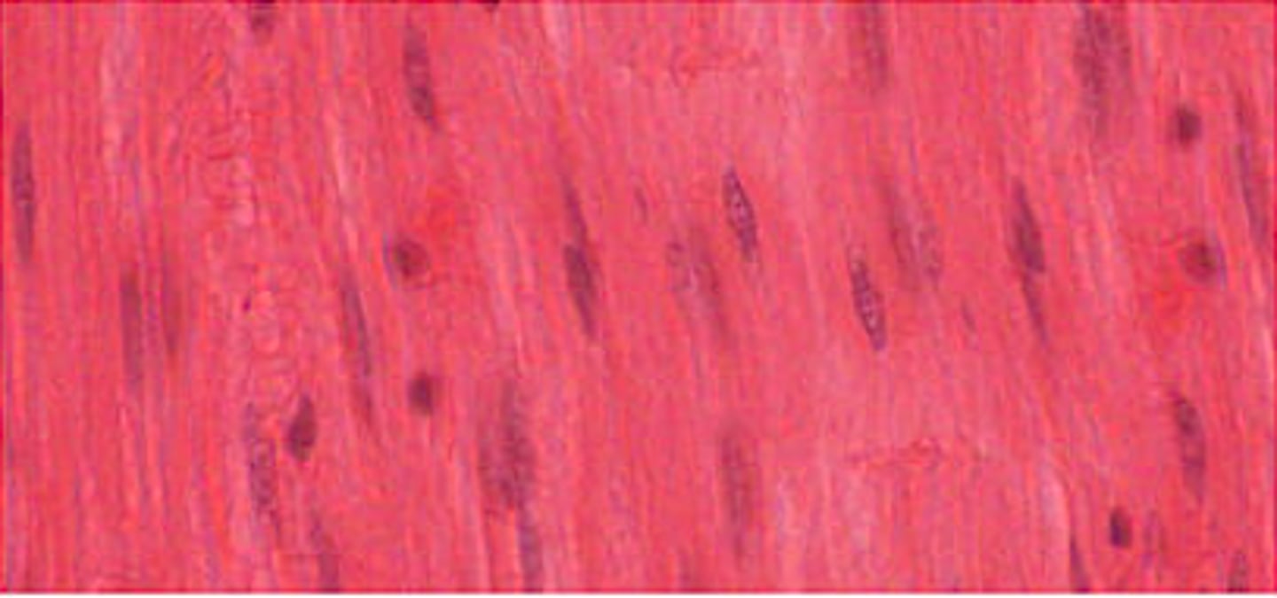 <p>Identify this tissue.</p>