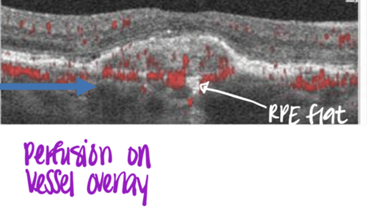 <p>What is this photo of? How do you know this?</p>