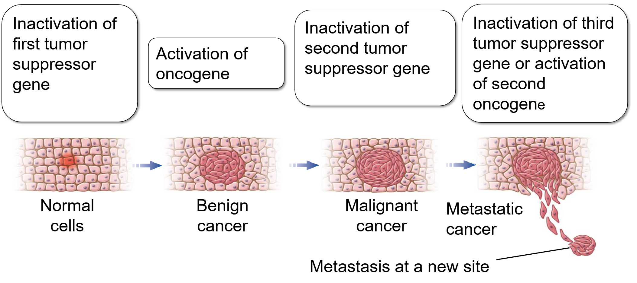 <ul><li><p><span><span>Require the </span><strong><span>accumulation</span></strong><span> of mutations in multiple genes (noy just one)</span></span></p></li><li><p><span><span>When several different cell cycle regulators fail, leading to both the </span><strong><span>overactivation</span></strong><span> of oncogenes and the </span><strong><span>loss</span></strong><span> of tumor suppressor activity, cancer will likely develop</span></span></p></li><li><p><span><strong><span>Benign</span></strong><span>: relatively slow growing and does not invade the surrounding tissue</span></span></p></li><li><p><span><strong><span>Malignant:</span></strong><span> grows rapidly and invades surrounding tissues</span></span></p></li><li><p>Ex. Colon Cancer → <span><span>Tumor cells contain at least one overactive oncogene and several inactive tumor suppressor genes</span></span></p></li><li><p><span><span>A cancer cell is one that no longer plays by the “rules” of a stable cellular community.</span></span></p></li></ul><p></p>