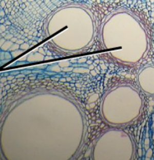 <p>conducts water, includes trachear elements and fibers</p>