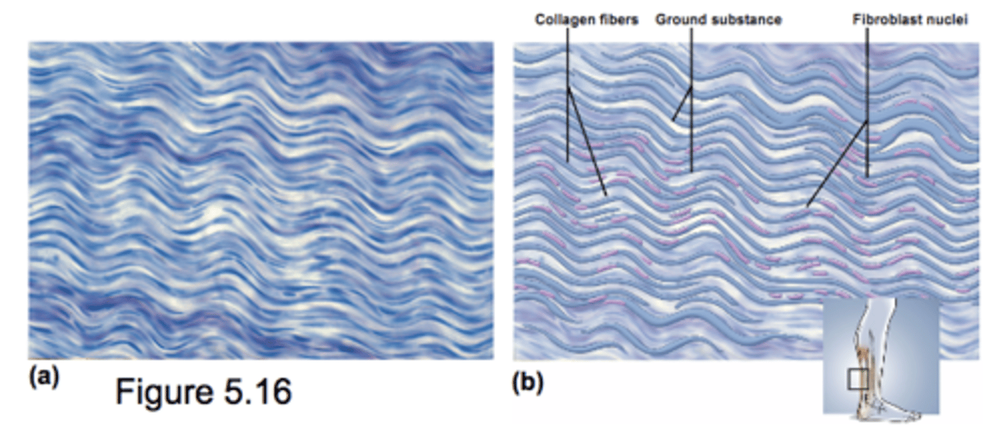 <p>Densely packed parallel collagen fibers</p><p>Compressed fibroblast nuclei</p><p>withstands stress in one direction</p><p>very low cellular component (Lots of extracellular collagen)</p><p>Tendons &amp; Ligaments</p>
