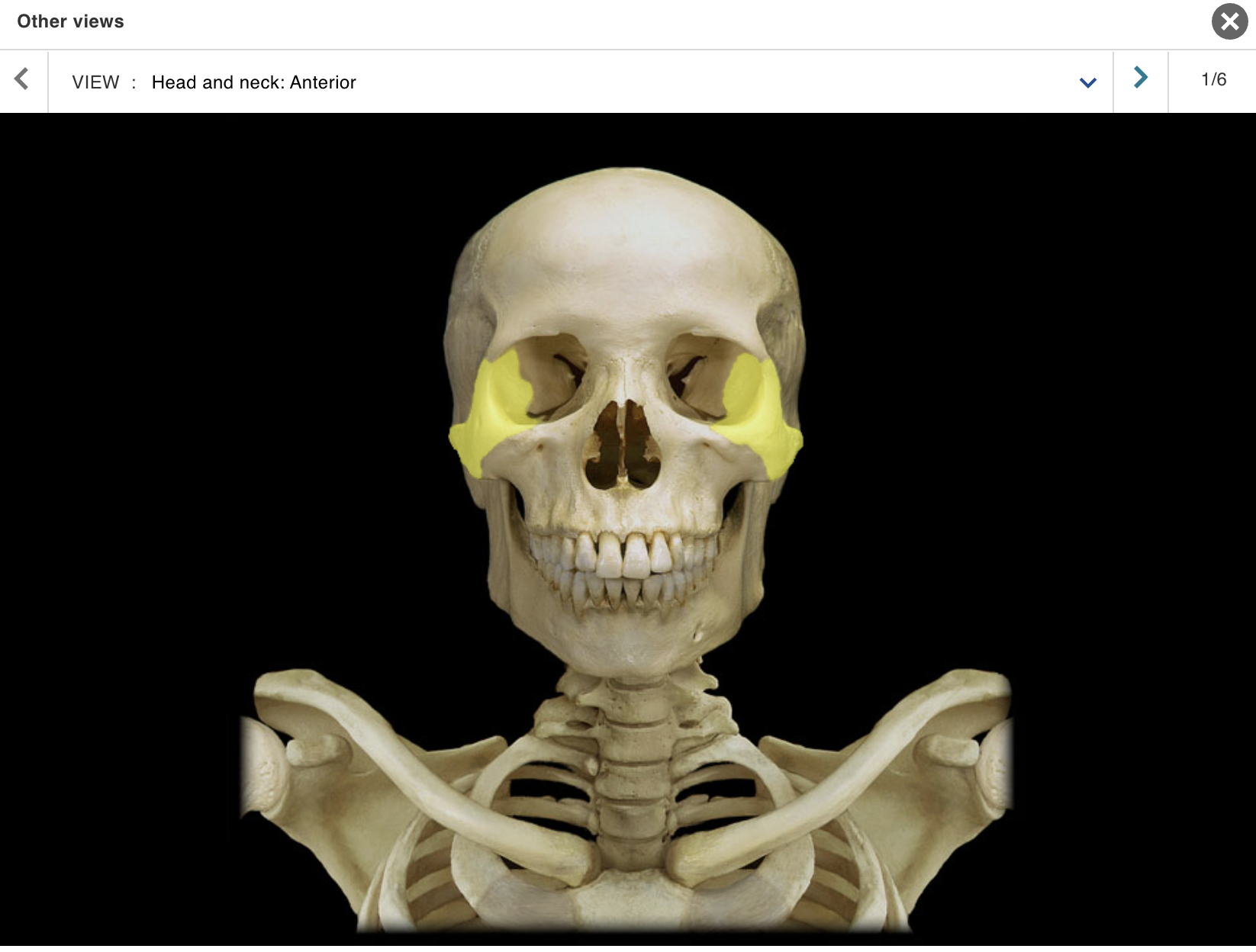 <p>Location:</p><p class="p1">• Skull (anterior and lateral)</p><p class="p1">Description:</p><ul><li><p>﻿﻿Paired, irregular-shaped bone</p></li><li><p>﻿﻿Temporal process contributes to zygomatic arch</p></li></ul><p class="p1">Also known as:</p><p class="p1">• "Cheekbone"</p><p class="p1">Comment:</p><p class="p1">• Forms part of floor and lateral wall of orbit</p>