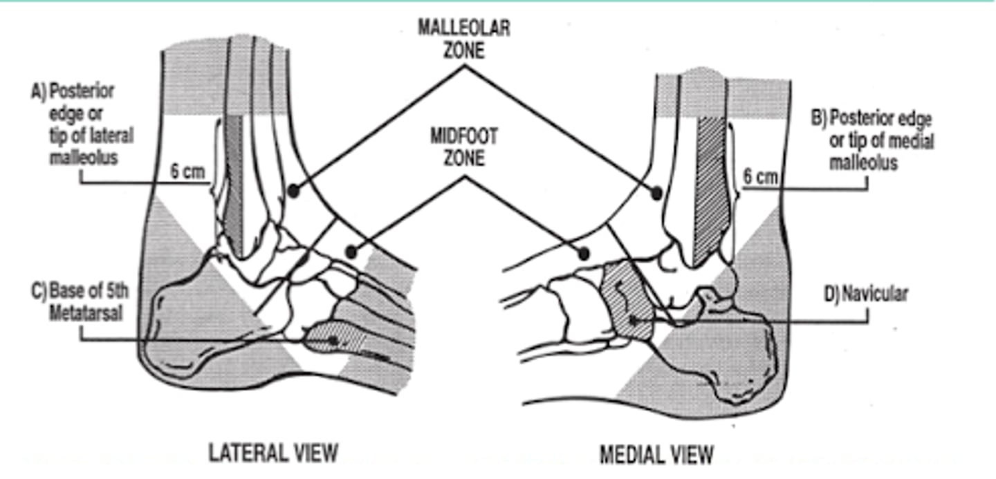 <p>ONLY if there is pain in the malleolar region and any of the following:</p><p>(A)</p><p>or </p><p>(B)</p><p>or </p><p>- inability to wear weight</p>