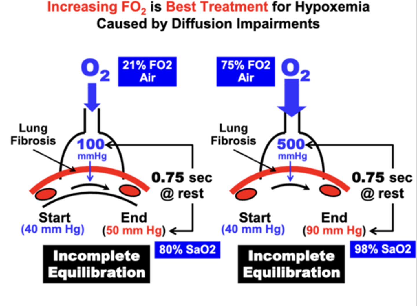 <p>Most Effective Treatment of Hypoxemia Due to a Diffusion Impairment is to have the patient Breathe Higher FO2 Air</p><p>- apparent from Fick’s Law of Diffusion, which indicates that increasing the partial pressure gradient (P1-P2) across the diffusion barrier, proportionately increases the rate of gas diffusion (Vgas)</p>