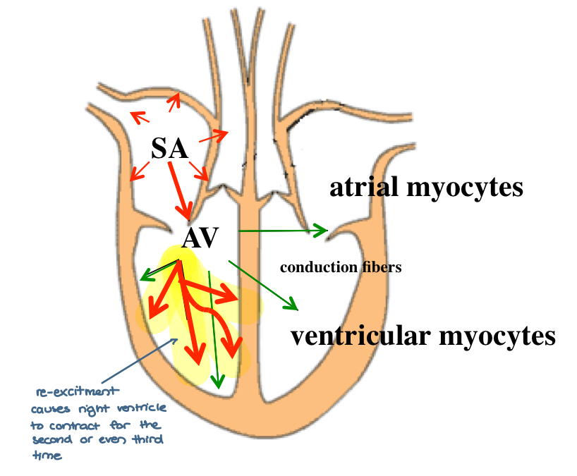<ul><li><p>occurs with the same impulse (re-excites)</p></li><li><p>post infarction scarring</p></li><li><p>low conductance</p></li></ul><p></p>