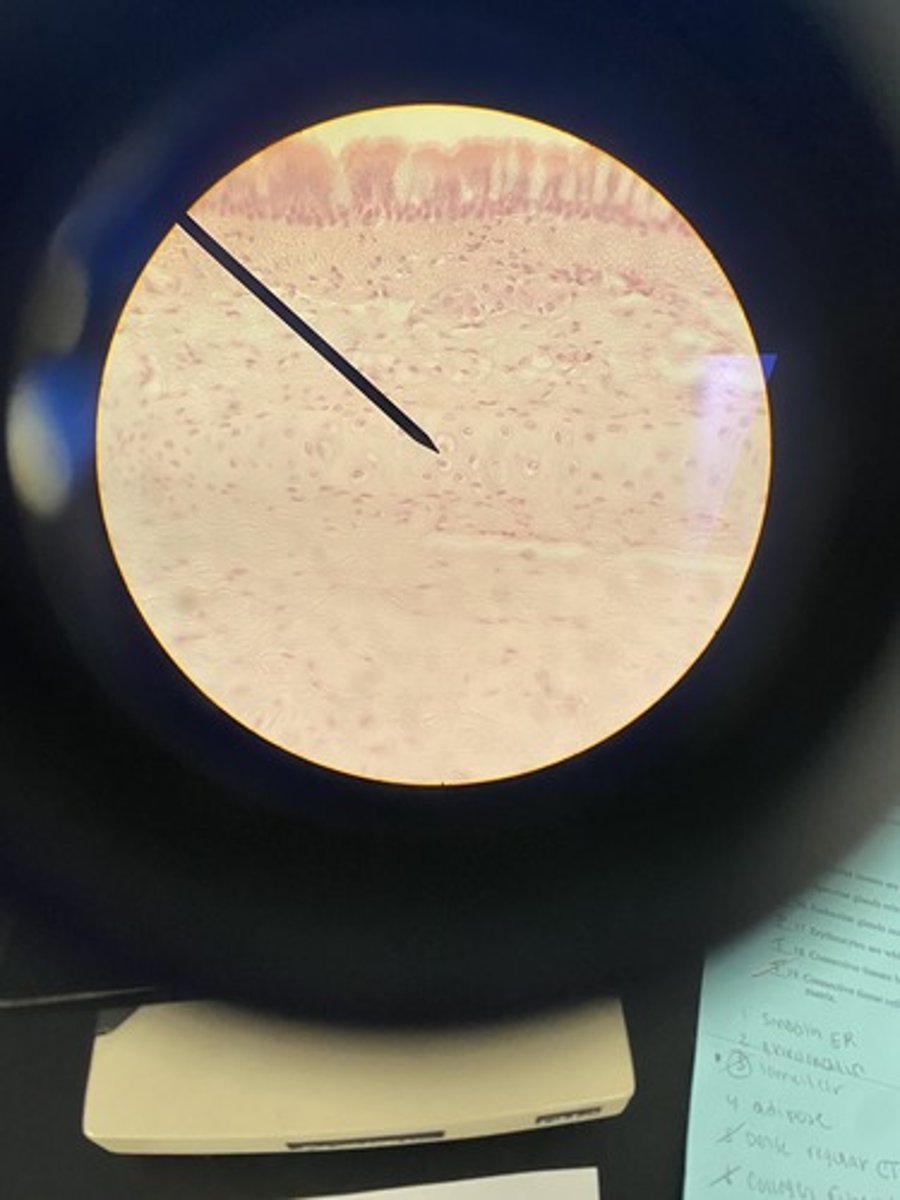 <p>Most common type of cartilage; long bones, ribs, and nose</p>