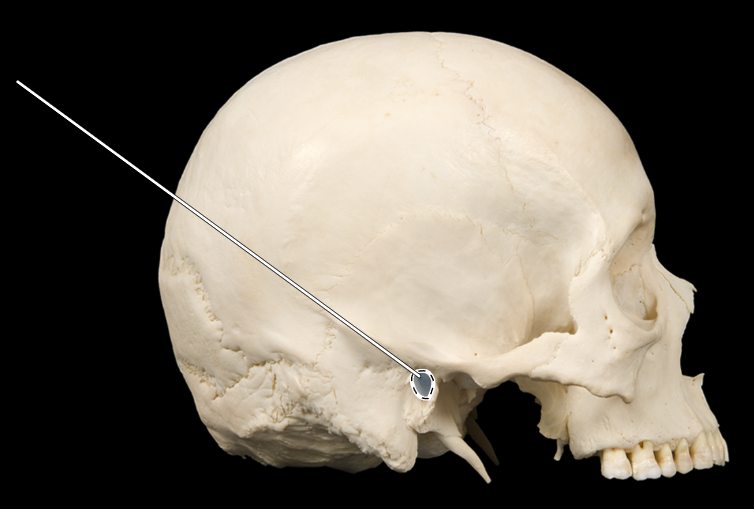 <p>Name the highlighted portion.</p><p>(Skull, lateral view).</p>