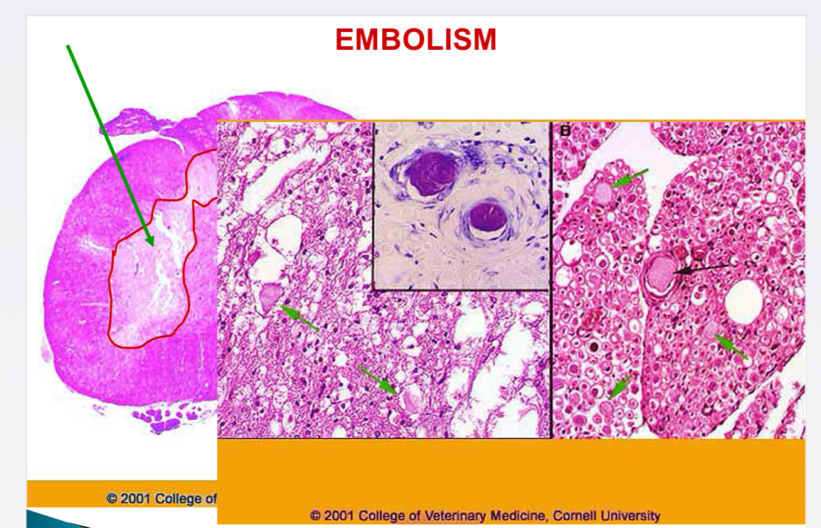 <p>Common site of fibro-cartilaginous embolism </p>