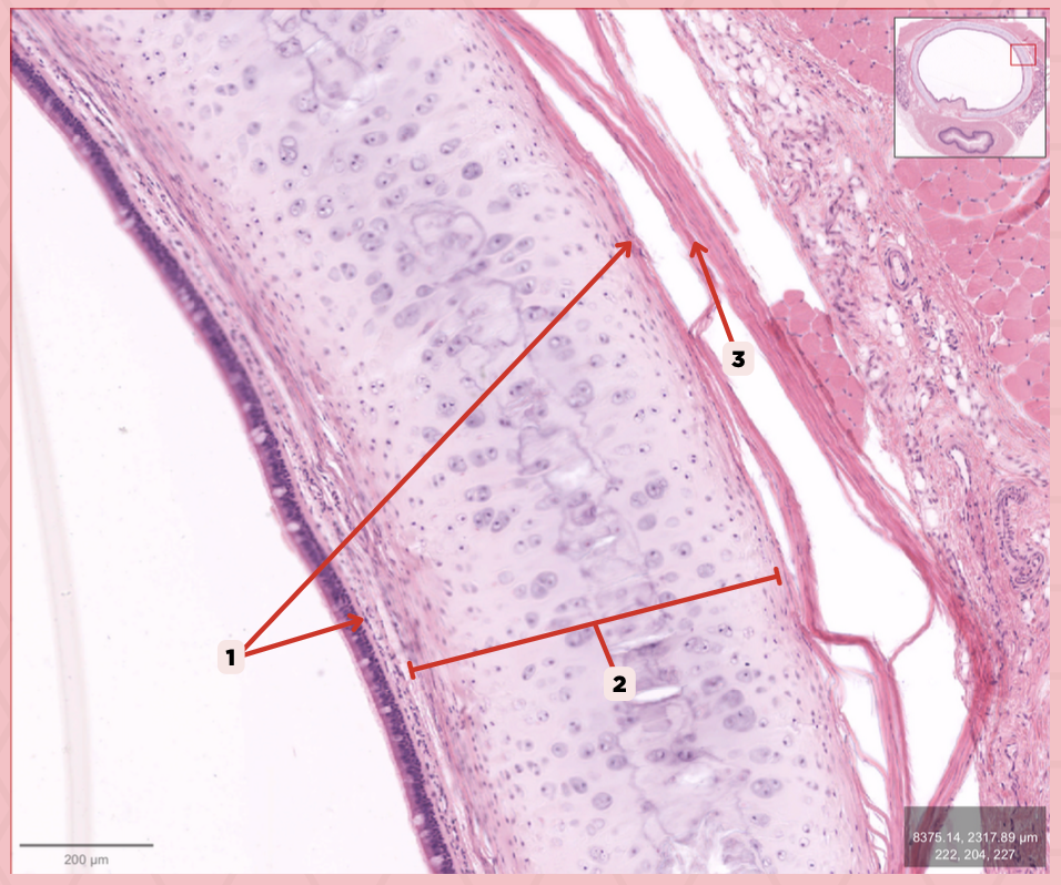 <p>Identify the structure labeled as 2.</p>