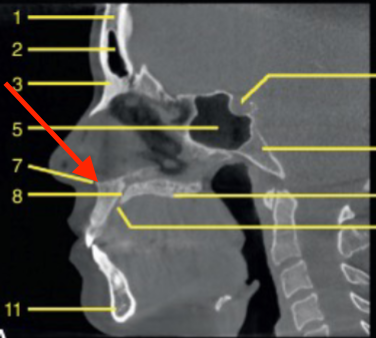 <p>identify the structure </p>