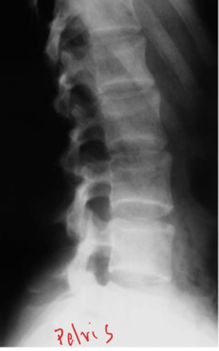 <p>What view is this?</p>