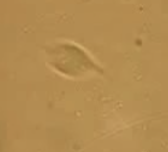 <p>tritrichomoniasis foetus- a single celled protozoan</p>