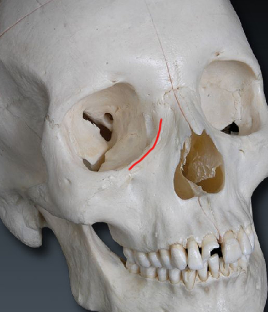 <p>vertical crest located on the lateral aspect of the frontal process of the maxilla; maxilla combines with the lacrimal bone to form lacrimal groove and canal</p>