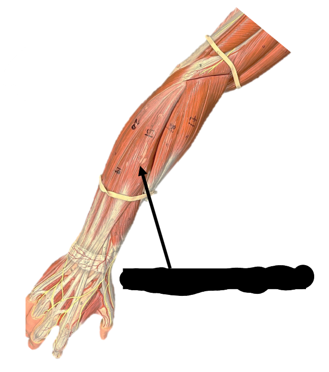 <p>Origin: lateral epicondyle of humerus</p><p>Function: extends fingers and wrist</p>