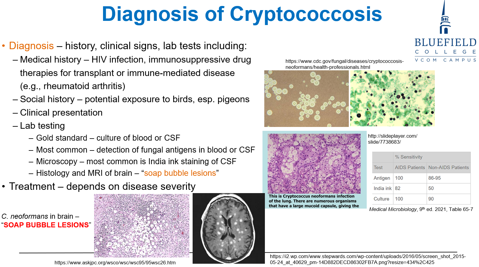 <p>C. Soap bubble lesions<br></p><p><strong>Clusters of yeast</strong> create <strong>"soap bubble" lesions</strong> in the <strong>basal ganglia and brain parenchyma</strong>.</p>