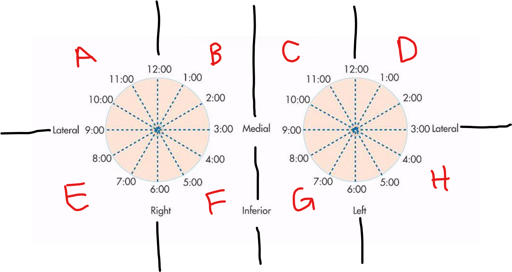 <p>A</p>
