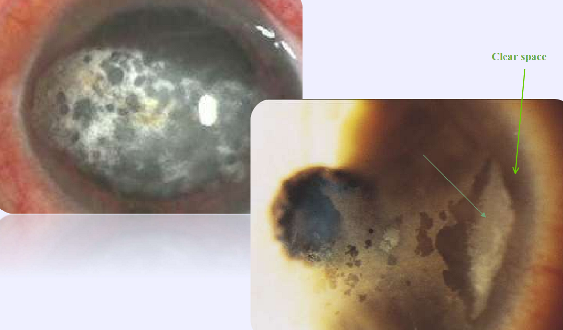 <p>What condition is this?</p>
