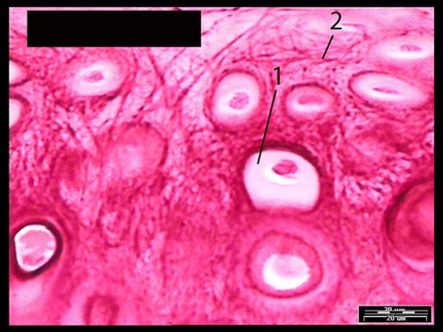 <p>Name the structure indicated by the number 1.</p>