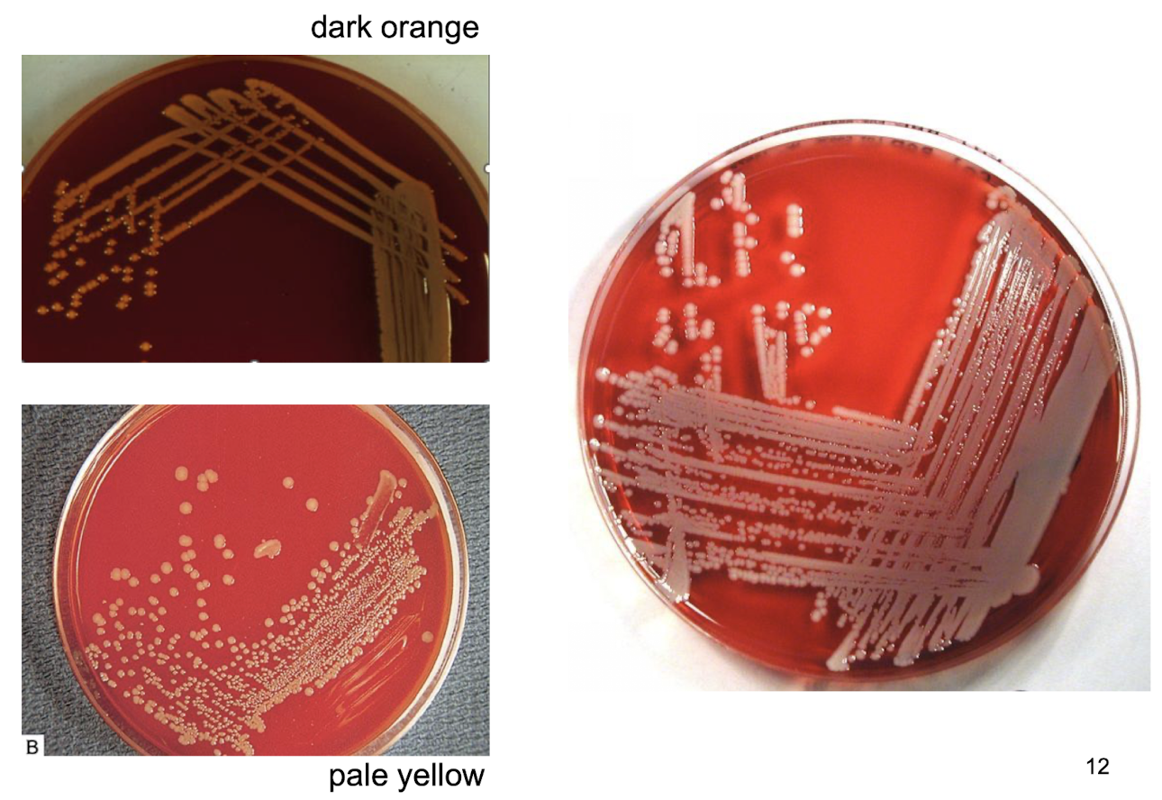 <p><em>S. aureus</em> <mark data-color="yellow" style="background-color: yellow; color: inherit;">(golden) </mark>typically forms <strong><mark data-color="#f3e19e" style="background-color: rgb(243, 225, 158); color: inherit;">golden-yellow colonies</mark></strong> that are<strong> sharply defined smooth, circular, and convex with a creamy texture on culture media 1-4mm in diameter</strong></p><ul><li><p>Exhibit <strong><u>complete haemolytic activity </u></strong>on blood agar, showing a <strong>clear zone</strong> around the colonies.</p></li></ul><p></p>