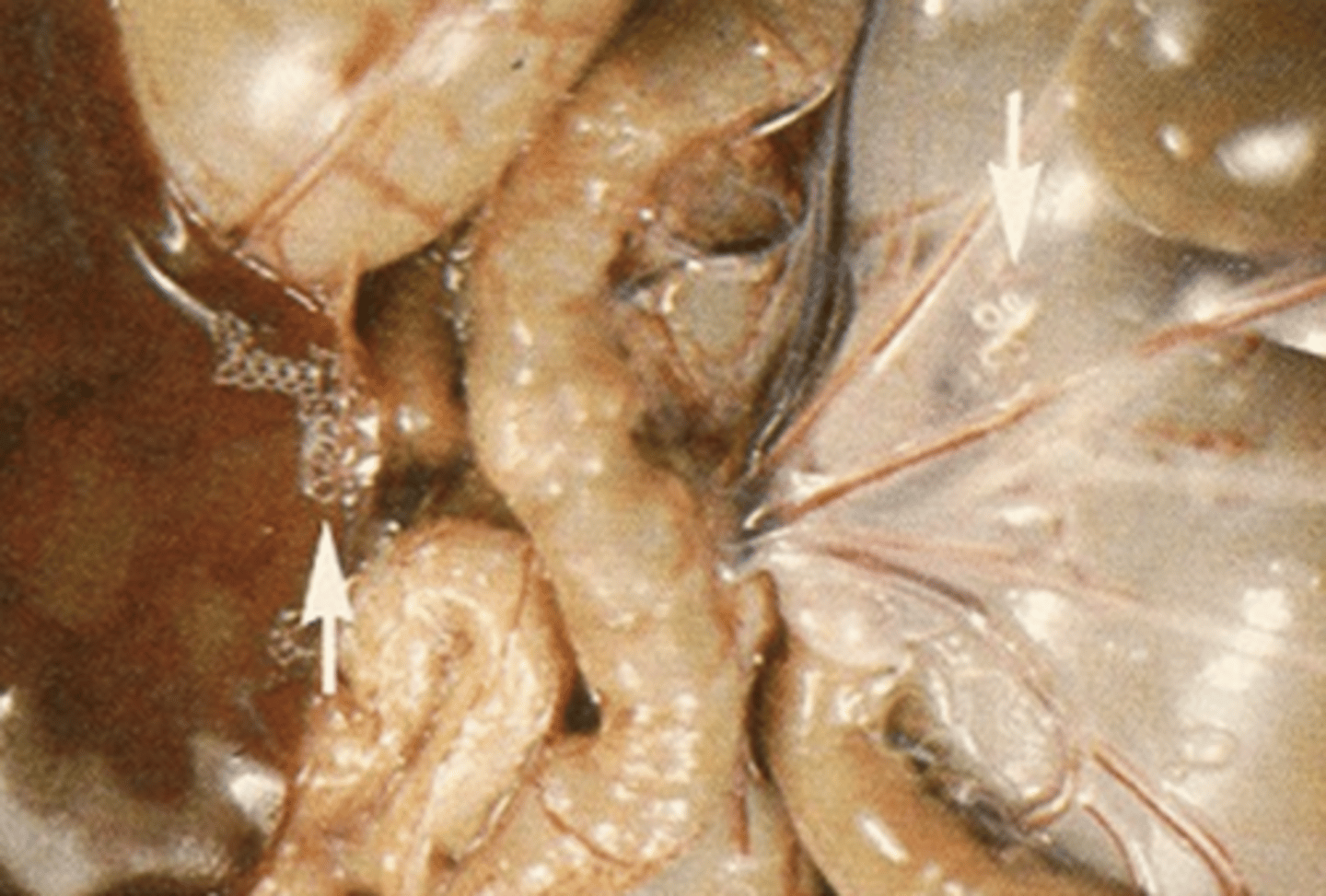 <p>what are these parasites in the peritoneum of this dog?</p>