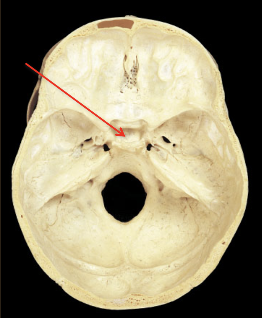 term image