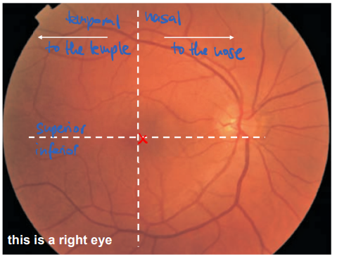 <p>the back inner surface of the eye is called the fundus </p>