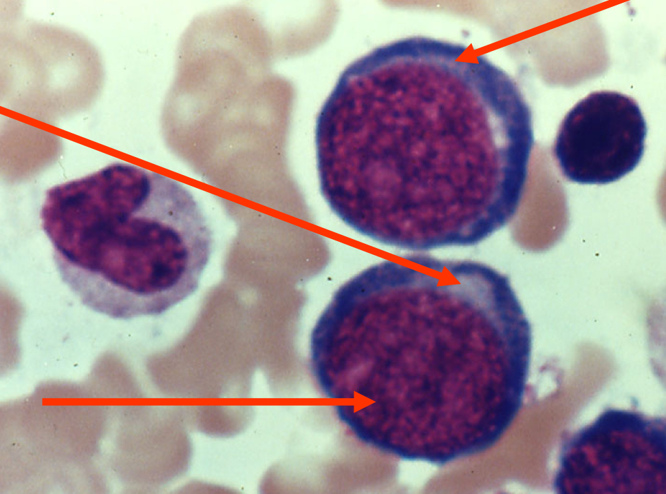 <p>What normoblastic maturation stage is in the image?</p>