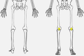 What bone is highlighted?