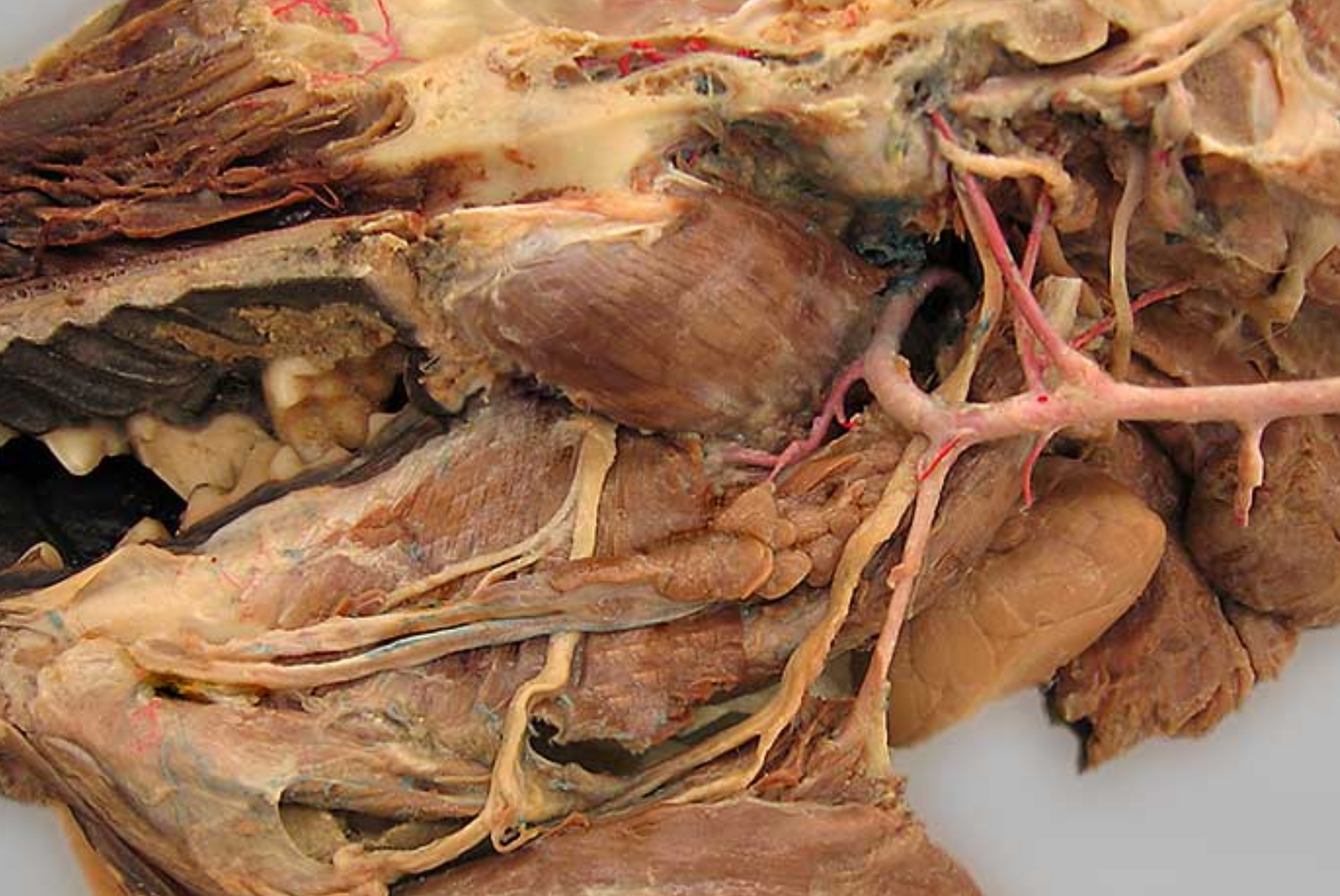 <ol><li><p>lingual nerve: from mandibular divison of trigeminal n., runs under tongue and on mylohyoid m.</p></li><li><p>mylohyoideus muscle: thin sheet than spans intermandibular space, caudally inserts on basihyoid</p></li><li><p>-</p></li><li><p>hypoglossal nerve: ventrorostral to carotid sheath, medial to mandib saliv gland, innervates tongue muscles</p></li><li><p>lingual artery: ventral branch of ECA, supplies tonsil &amp; tongue</p></li><li><p>styloglossus muscle: arises from stylohyroid bones, located in the tongue, retrats &amp; elevates tongue</p></li><li><p>pterygoid muscle: arises from pterygopalatine fossa, on medial side of mandible</p></li><li><p>digastricus muscle: extends from base of skull to lower mandible, involved in mastication</p></li><li><p>mandibular salivary gland: golf ball shape</p></li></ol><p></p><p>mandibular branch of cranial nerve V (this splits into MIL → …, inferior alveolar nerve, lingual nerve)</p>