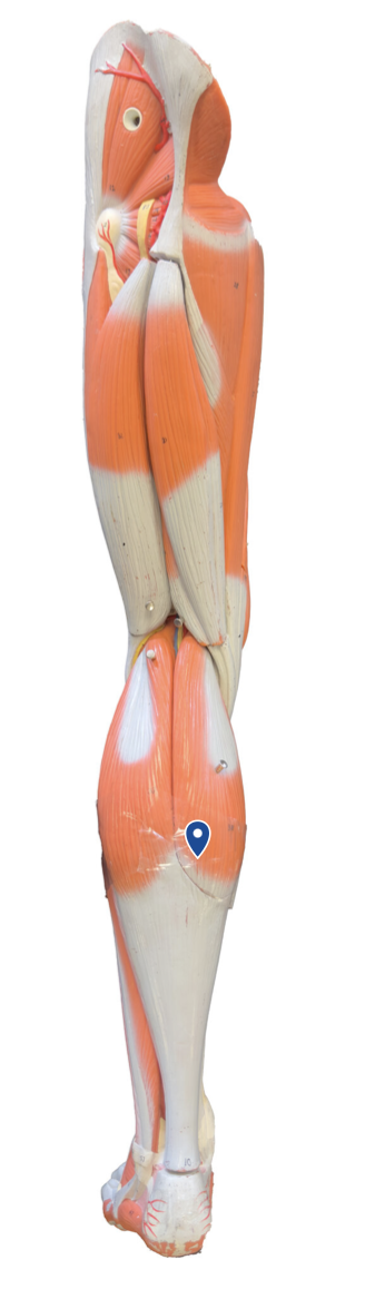 <p>What muscle is the arrow pointing to?</p>