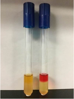 <ul><li><p><strong>Purpose</strong>: to determine mixed acid fermentation (lactic, acetic, formic, etc)</p><ul><li><p>Part of the IMViC tests.</p></li></ul></li><li><p><strong>Medium</strong>: MRVP broth--buffered peptone glucose broth</p></li><li><p><strong>Type of Medium:</strong> differential</p></li><li><p><strong>+ results</strong> = red</p></li><li><p><strong>- results</strong> = yellow</p></li><li><p><strong>weak +</strong> = orange</p></li><li><p><strong>significant specific ingredients:</strong></p></li><li><p><strong>reagents/indicators</strong>: methyl red (added AFTER incubation)</p></li><li><p><strong>specific directions</strong> (if any): broth is inoculated and incubated. After incubation, add 5 drops of Methyl Red indicator, do not shake the tube, and read the results immediately</p></li><li><p><strong>significant results:</strong></p></li></ul>