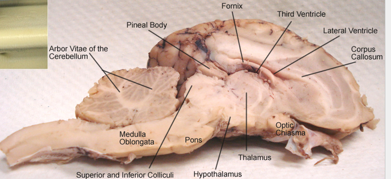 <p>sheep brain</p>
