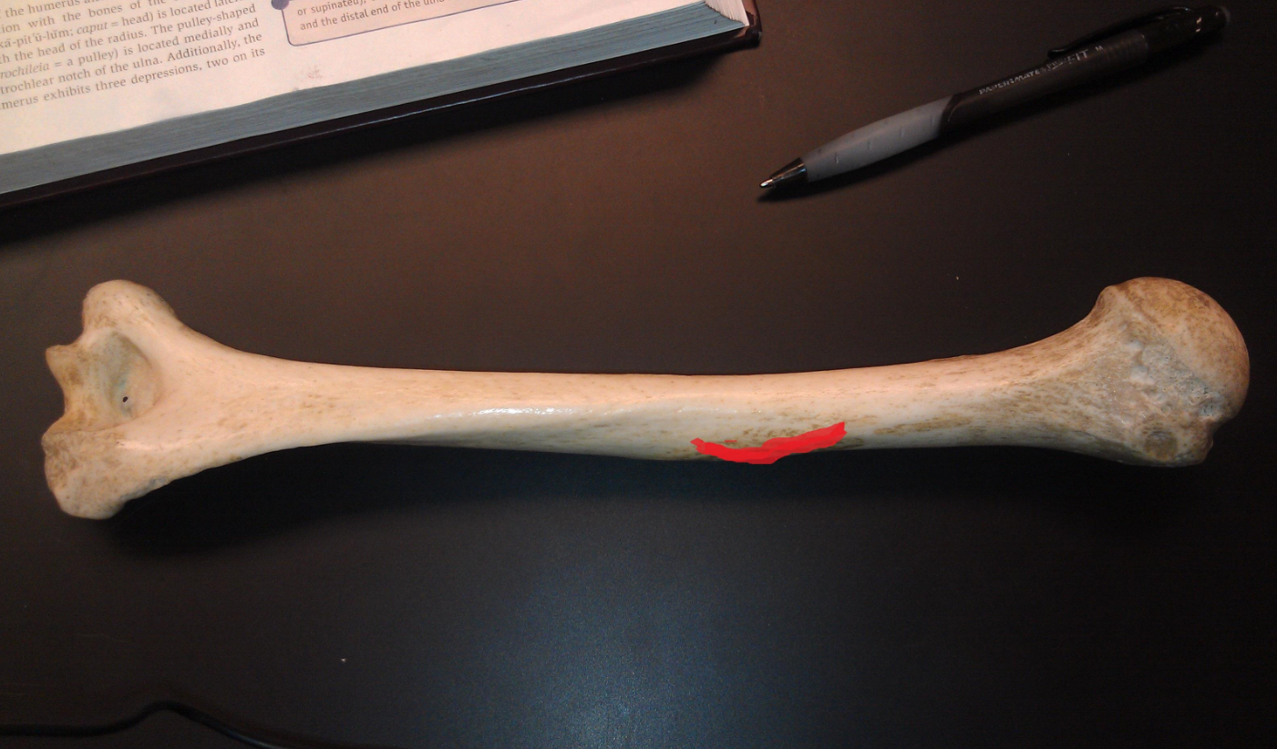 <p><span>Identify the bone marking (ridge/bump) lined in red.</span></p>