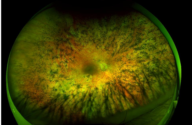 <p>What do you see here? What would change if i told you the person in this photo is deaf?</p>