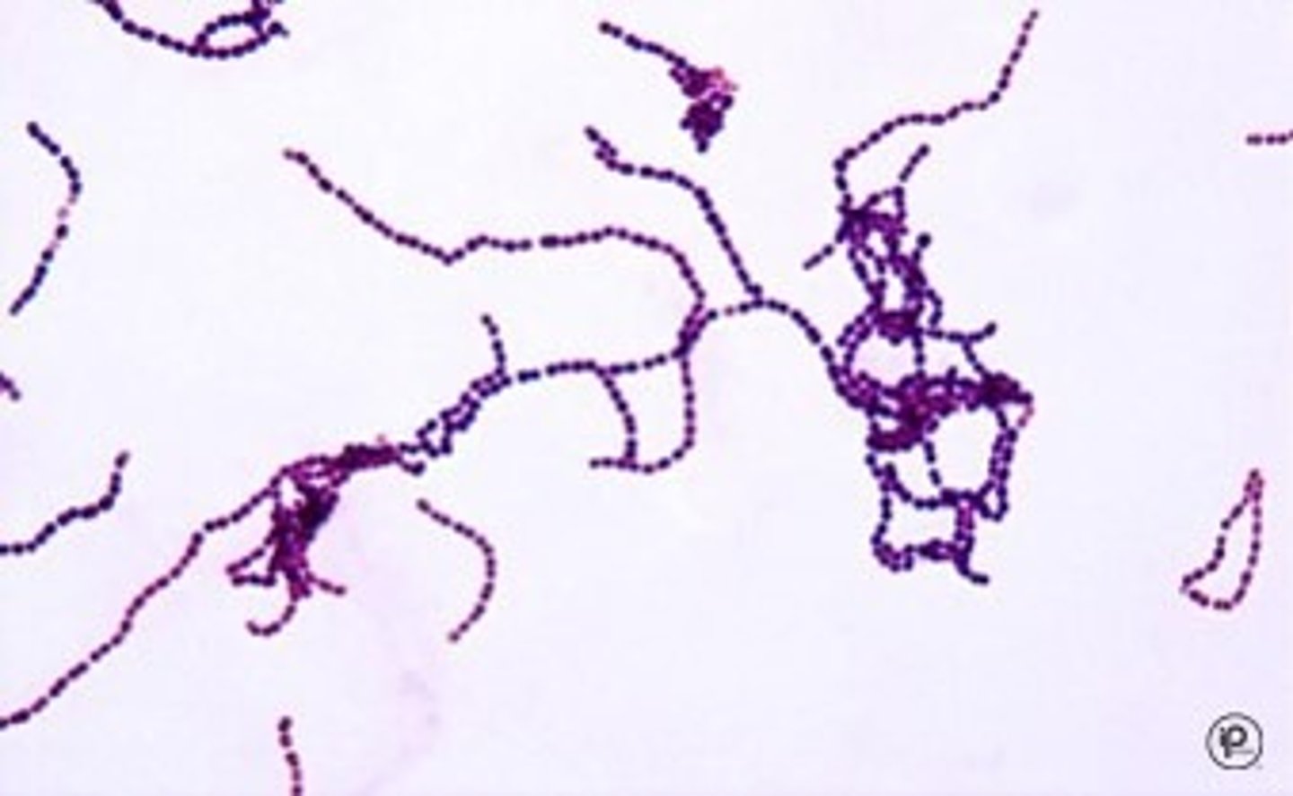 <p>-Gram-positive cocci<br>-facultative anaerobe<br>-grow in chains<br>-catalase-negative</p>