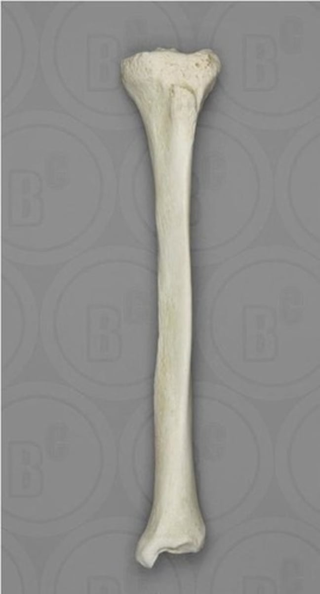 <p>ID bone</p>