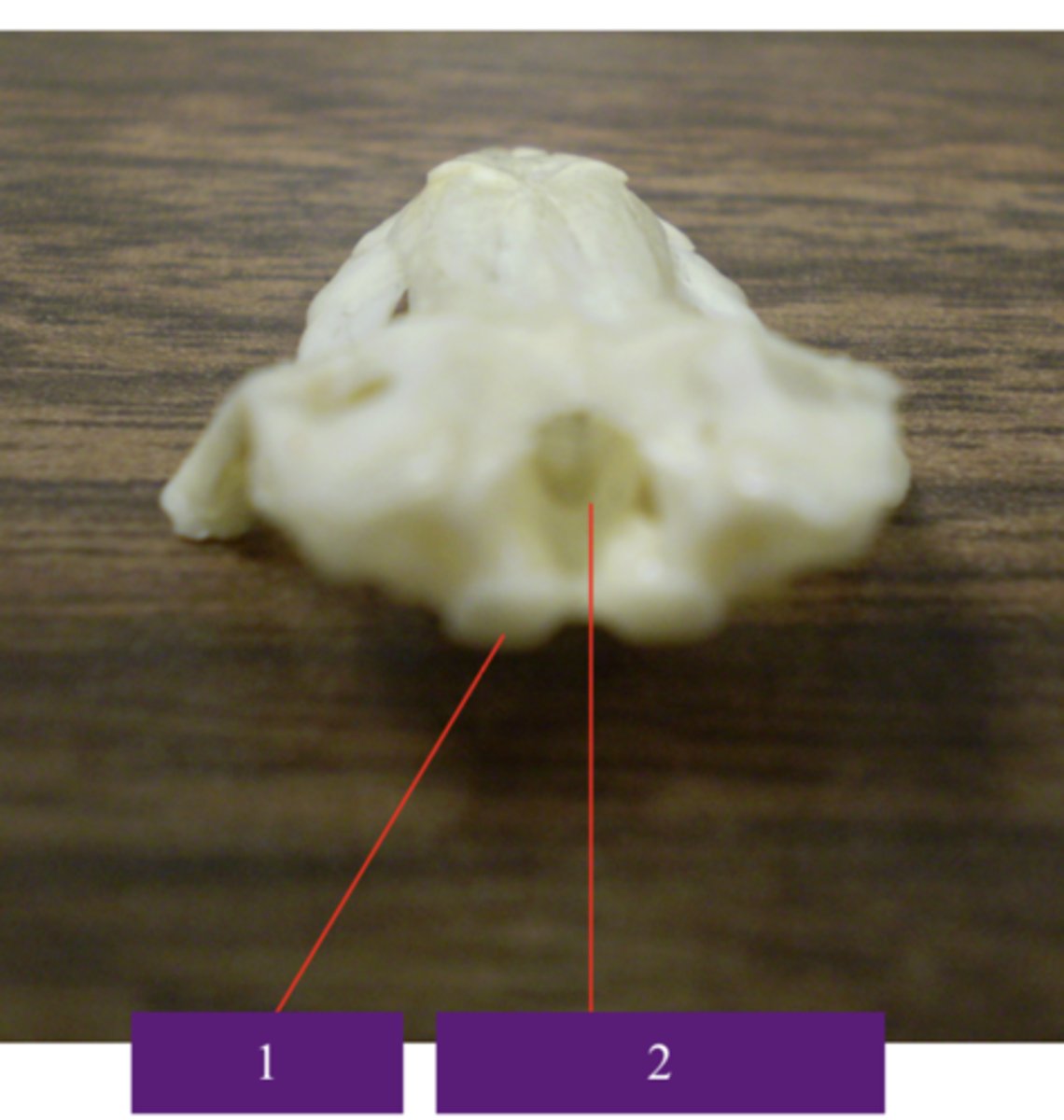 <p>What does number 1 point to?</p>