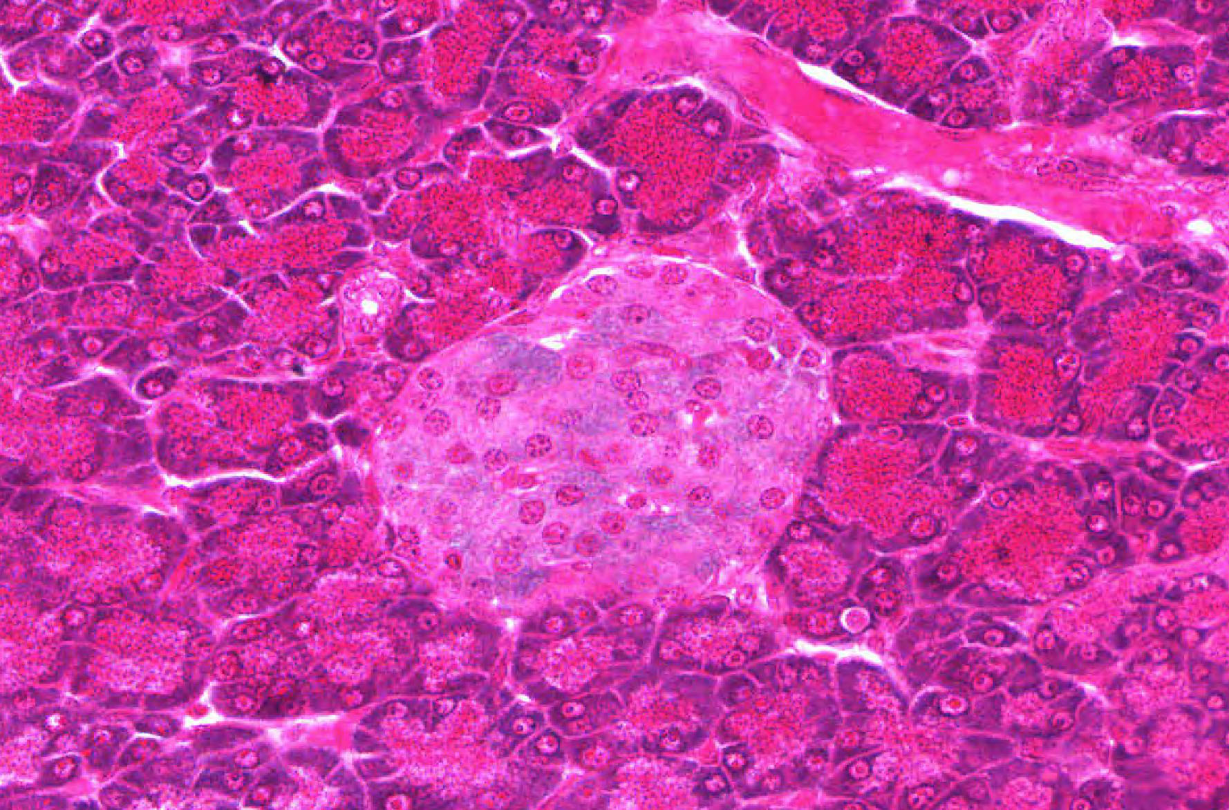 <p>Pancreas</p>