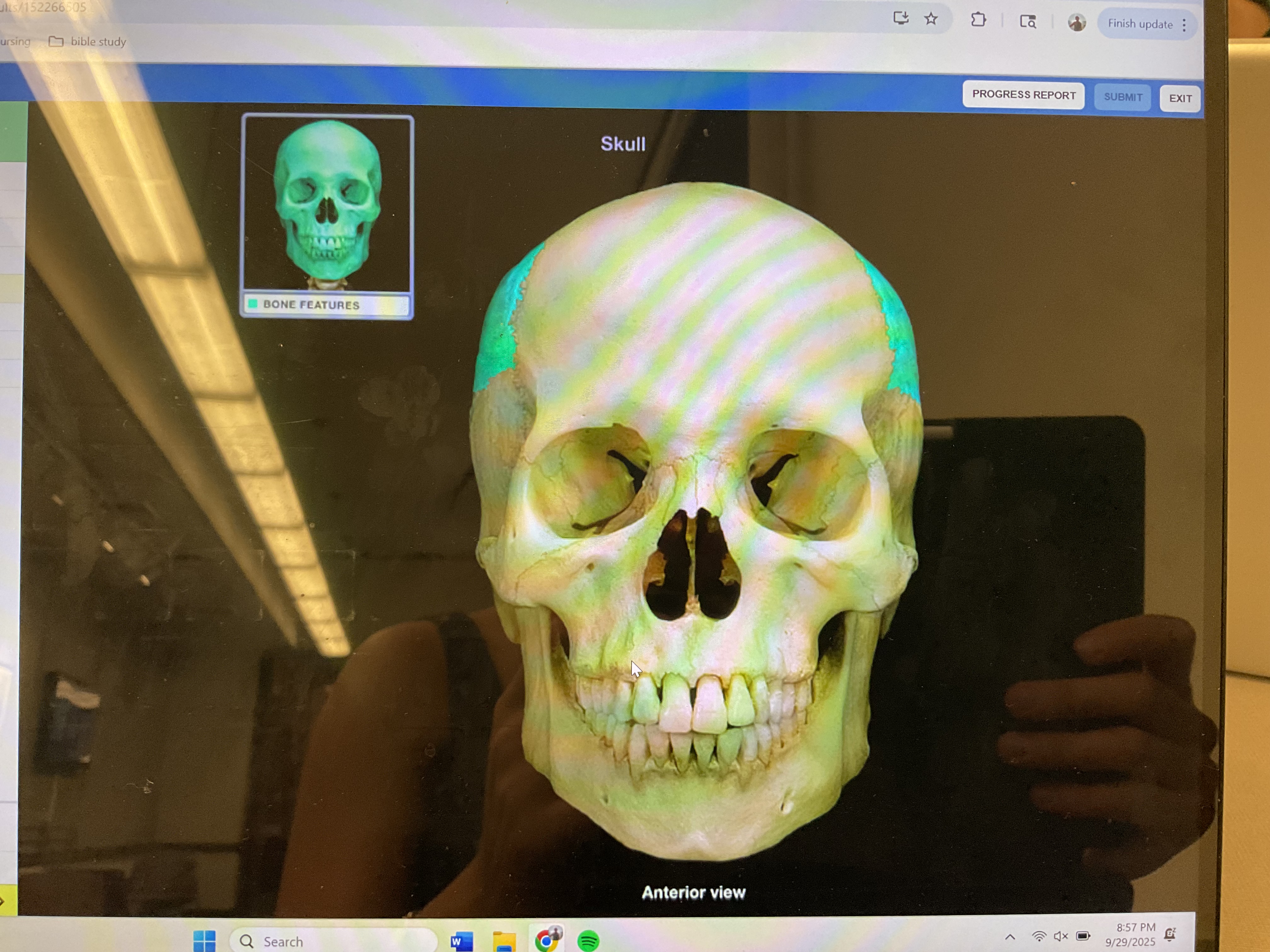 <p>Parietal bone </p>