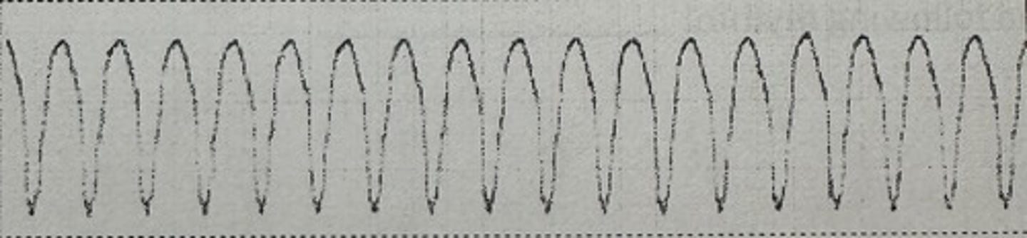 <p>identify the rhythm</p>