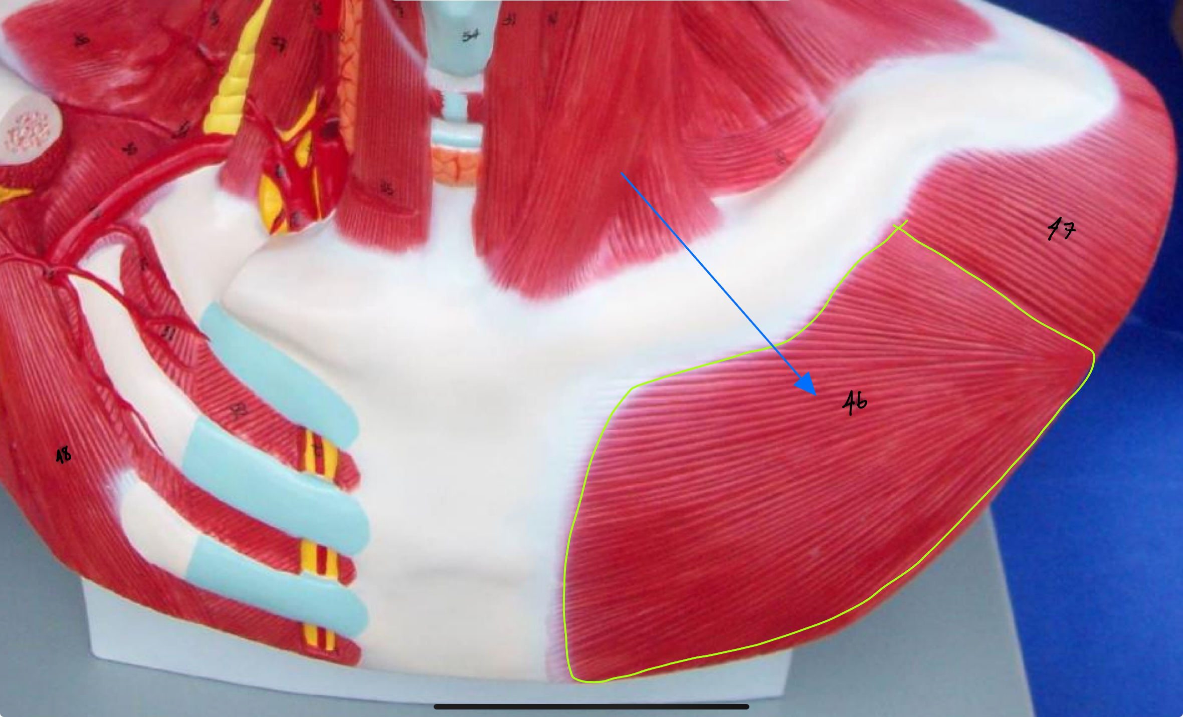 <p>What type of muscle is this ( altay model )</p>