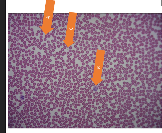 <p>what tissue is this </p>