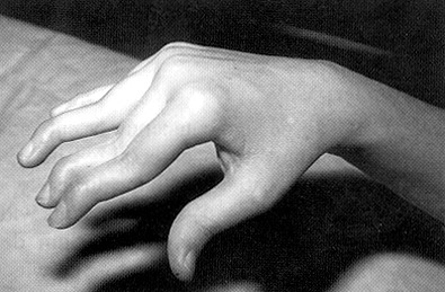 <p>abnormally formed parts of the body</p>