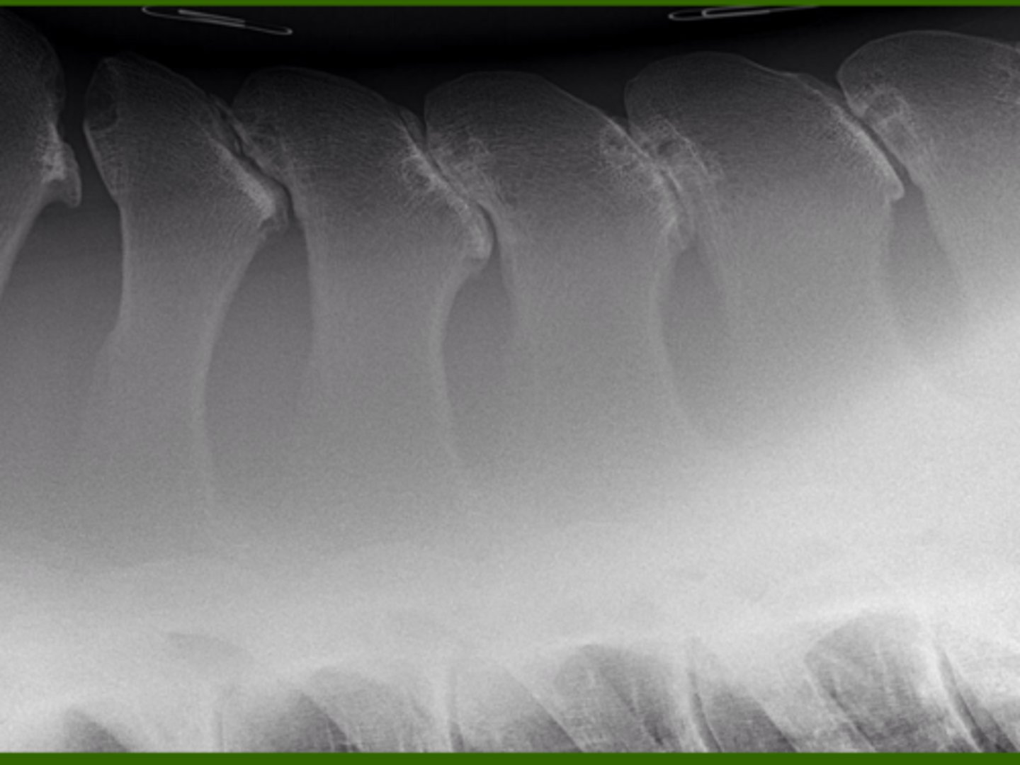 <p>What is the pathology?</p>