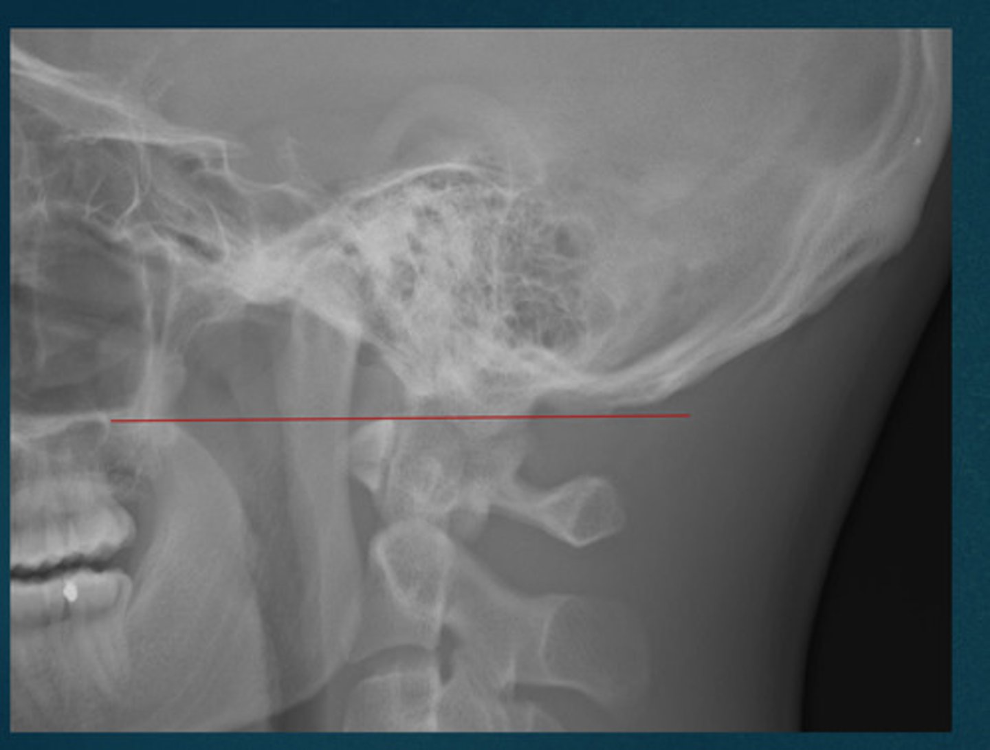 <p>What line of mensuration is this?</p>