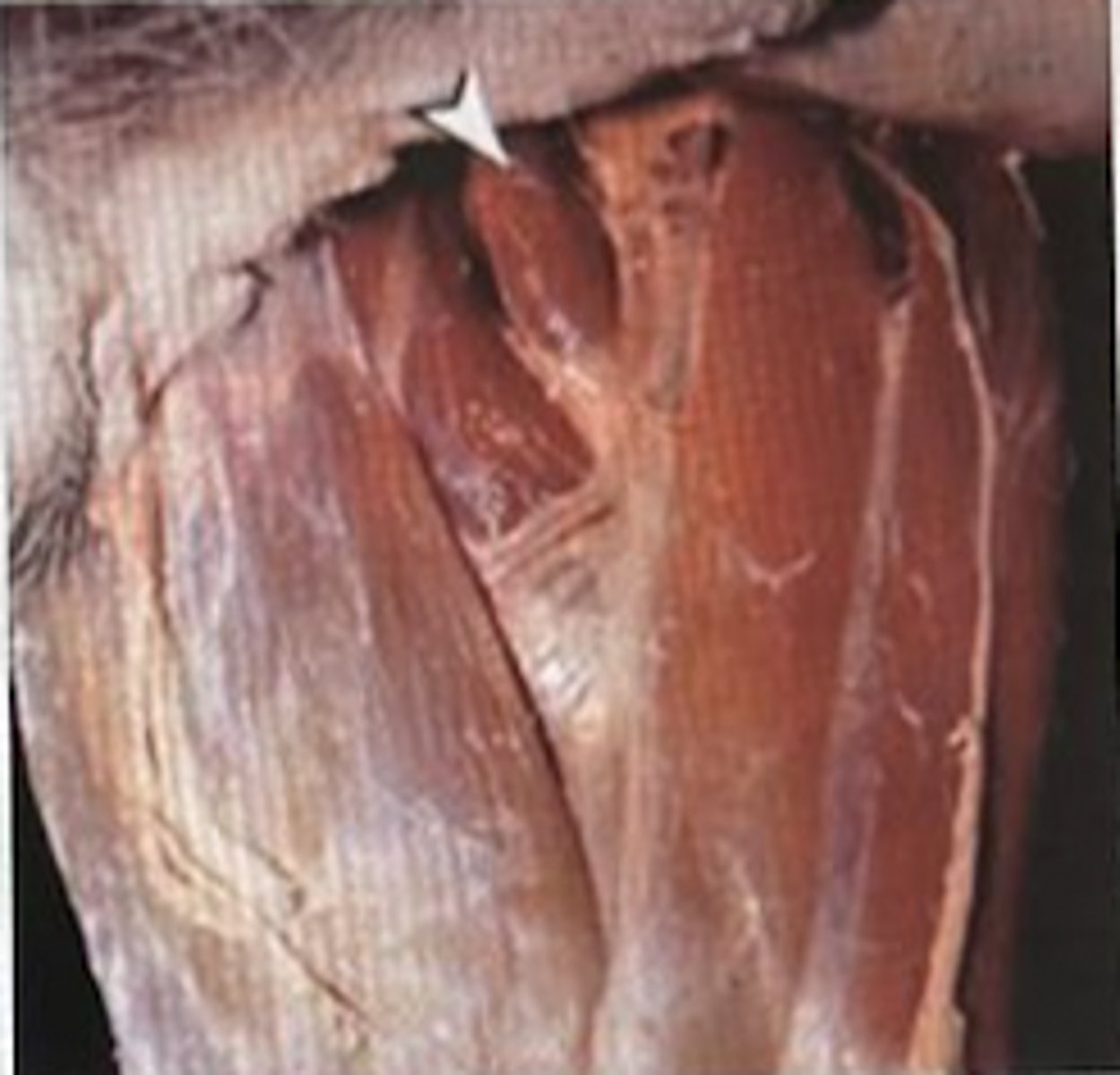 <p>B</p>