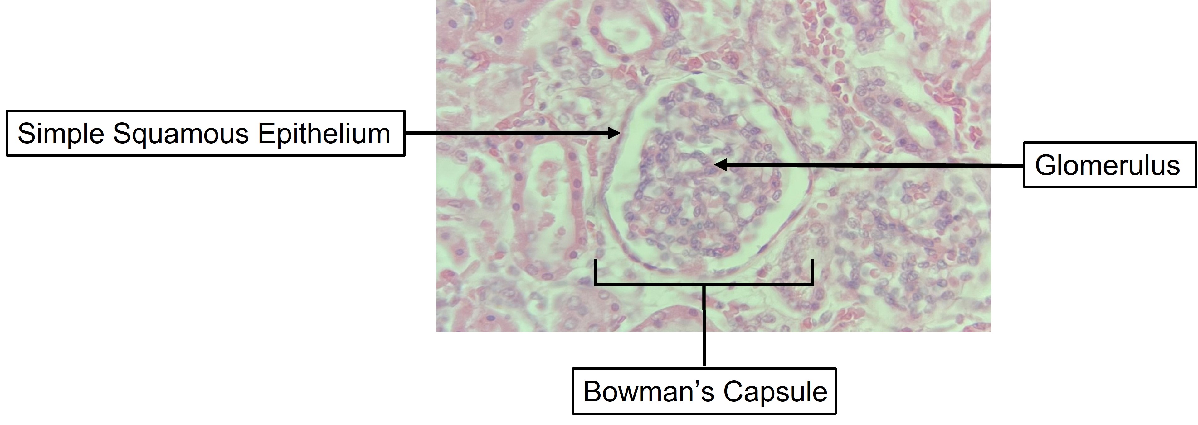 <p>Simple Squamous Epithelial </p><p>Location : Bowman’s Capsule (as shown in image, but can also be found in the endothelium &amp; alveoli)</p>