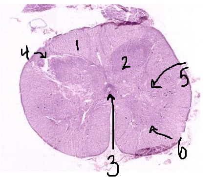 <p>What is #5 pointing to?</p>