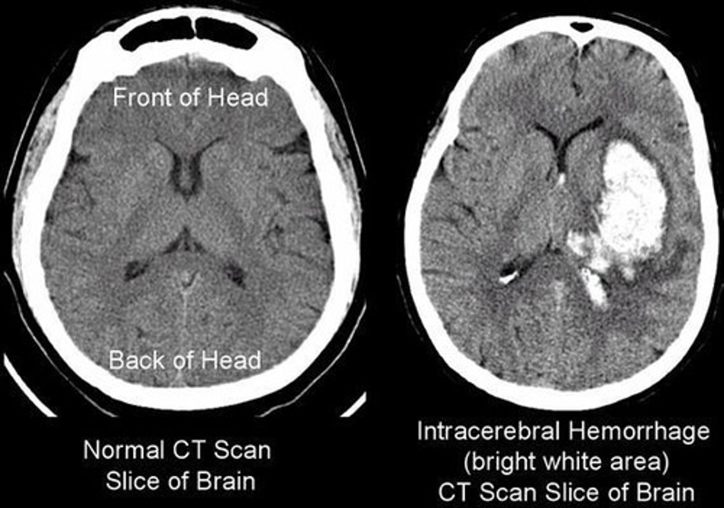 <p>X-ray imaging, ultrasound sonography, and computed tomography (CT) scans.</p>