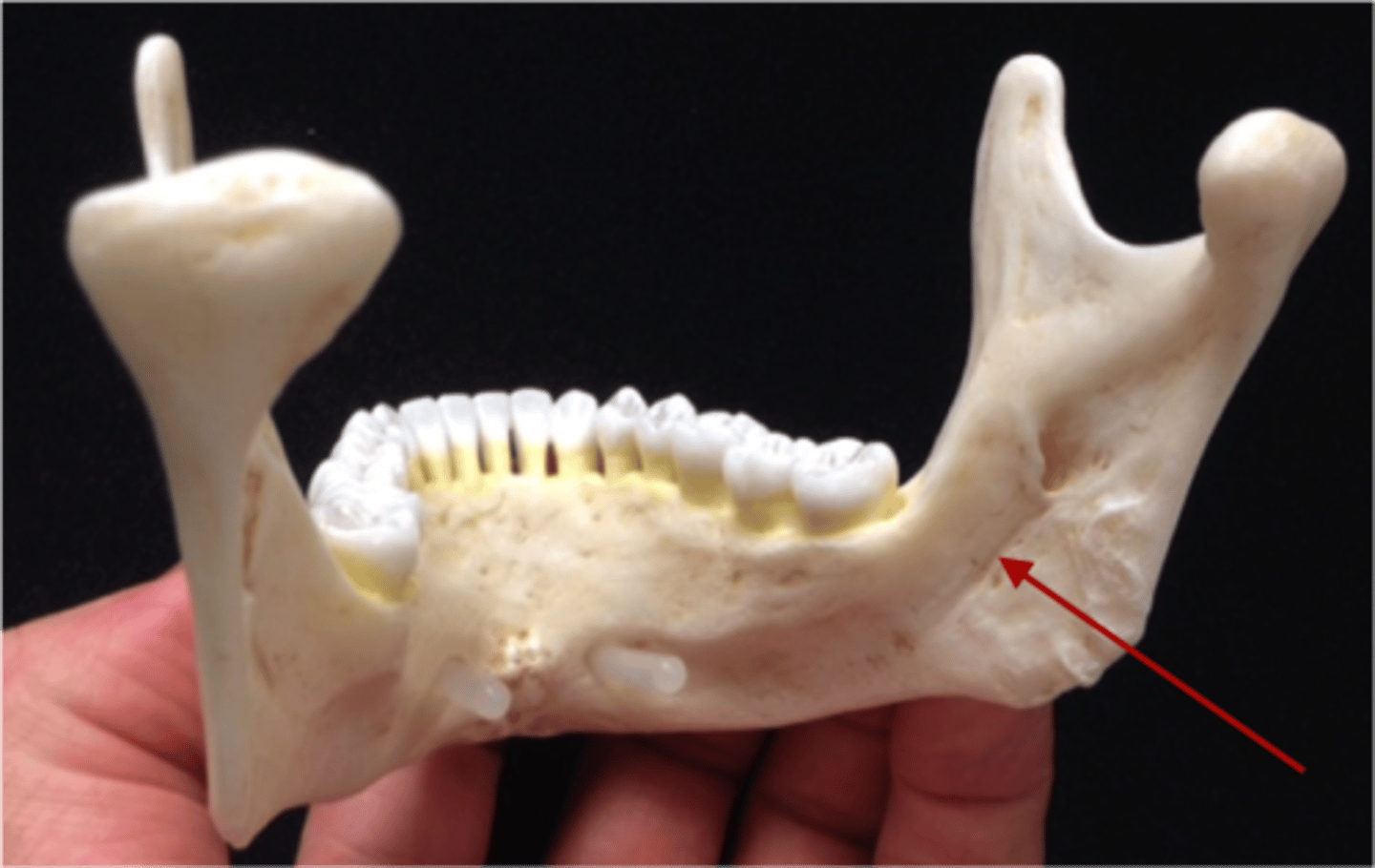 <p>What feature on the mandible is this? (Interior)</p>